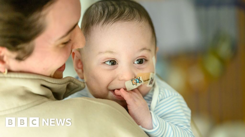 Toddler home for Christmas after 18 months in hospital